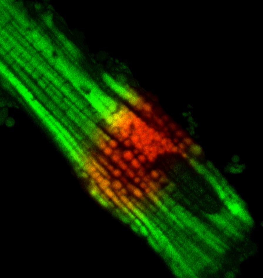 Mitochondrial Circuit Breaker