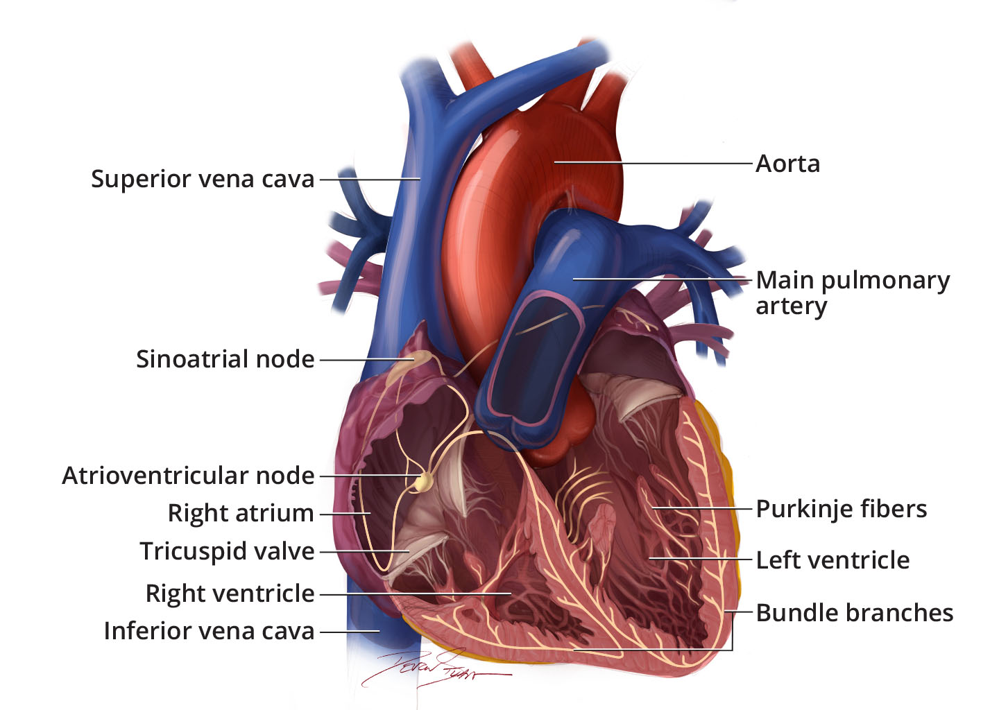 Arrhythmias - Conduction Disorders | NHLBI, NIH