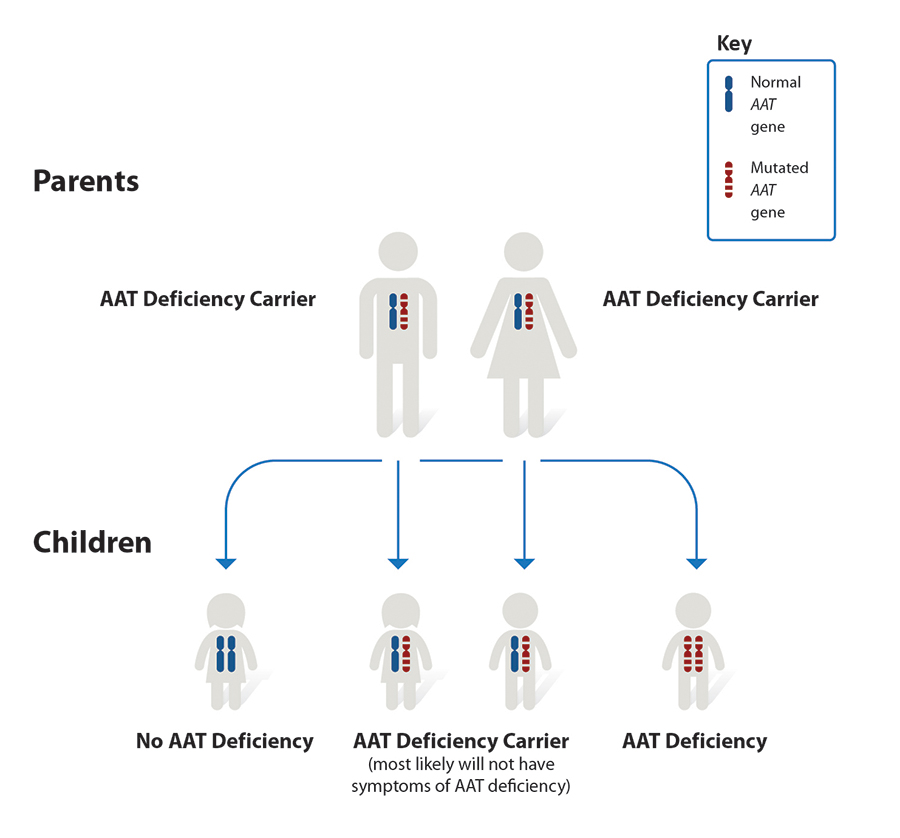 COPD Alpha1 Antitrypsin Deficiency NHLBI, NIH