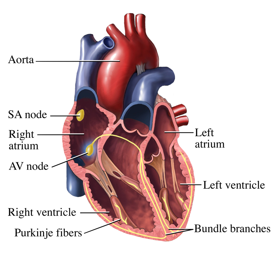 Arrhythmias - Conduction Disorders | NHLBI, NIH