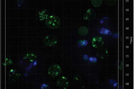 Sickle cell red blood cells retain mitochondria. 