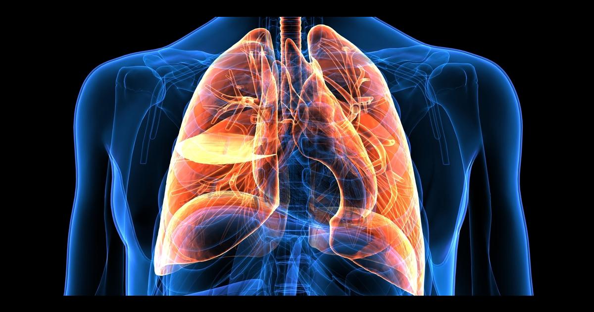 NHLBI Unveils COPD National Action Plan | NHLBI, NIH